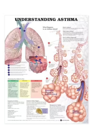 Understanding Asthma Anatomical Chart
